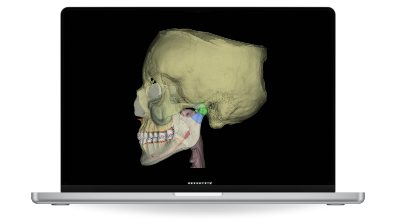 Segmentation anatomique assistée par IA dans Ez3D-i